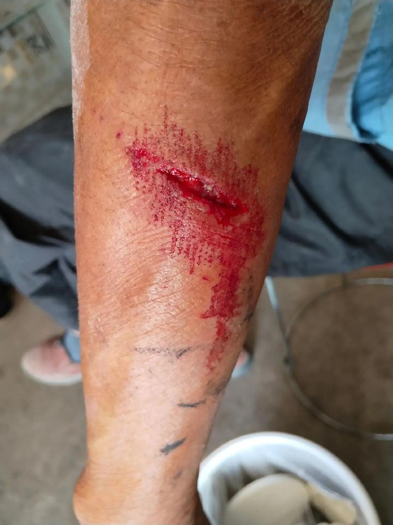 咸阳申通快递打架致伤,原因是什么?